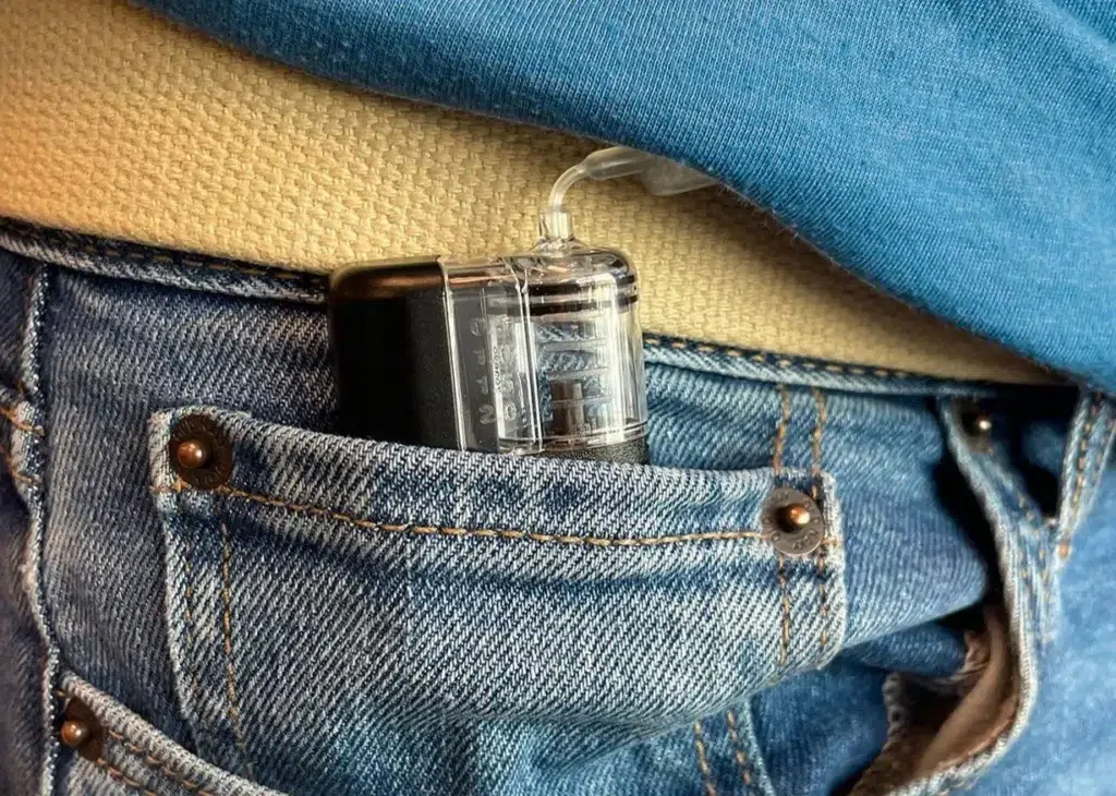 Tandem+Mobi+Insulin+Pump+Fits+in+Pocket-6e8b5376-1920w