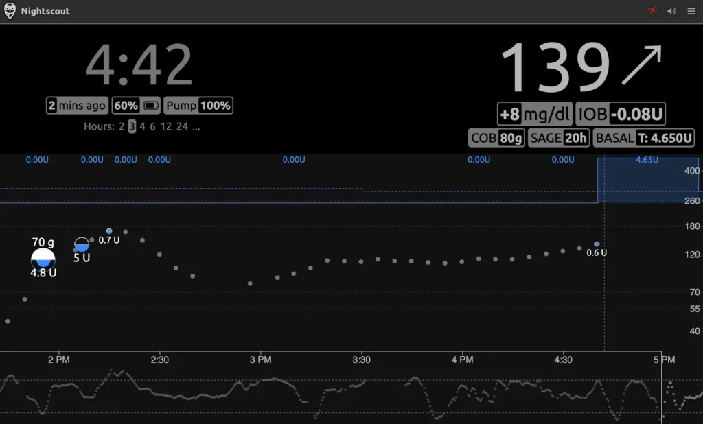 nightscout-630-1920w nightscout 630 1920w